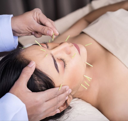 cosmetic acupuncture