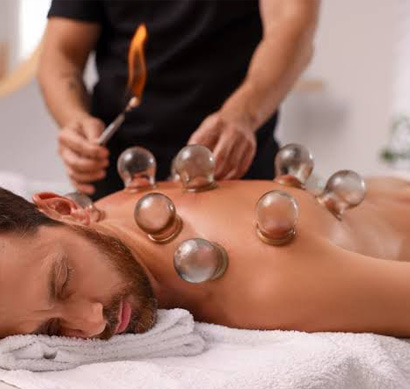 Cupping Therapy