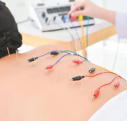 ELECTRICAL STIMULATER