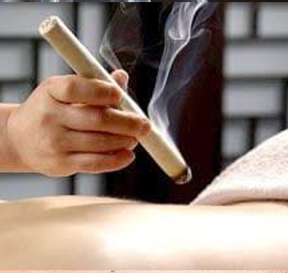 Moxibustion