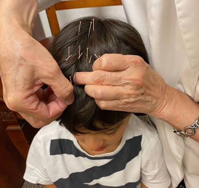 Scalp